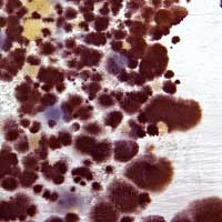 House Mold Household Mold In Basement Is A Significant Problem