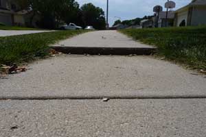 PolyLevel&reg; Before