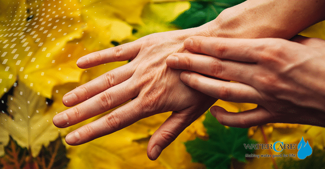 Dry hands with autumn leaves in background