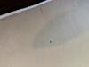 Bed Bugs Came with the Visitor in Hillsborough, NJ - Photo 2