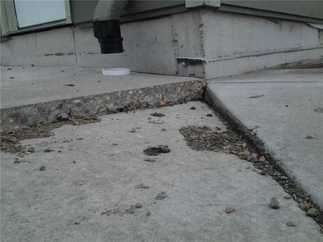 Before PolyLevel Injection in Webster, MN