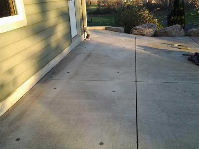 After PolyLevel Injection in Webster, MN