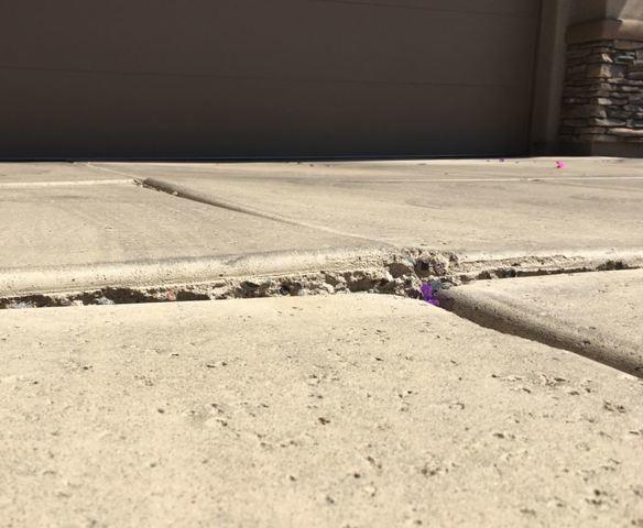 Before PolyLevel® Injection