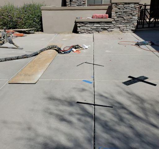 Mid PolyLevel® Injection - 1