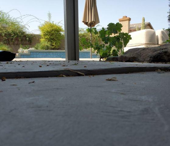 Before PolyLevel® Injection - 1