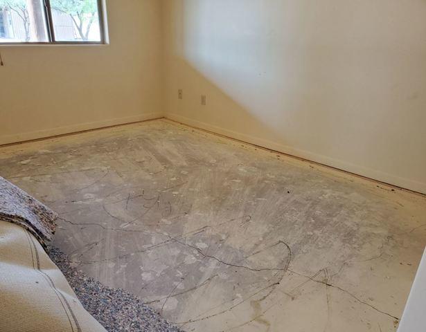 After PolyLevel® Injection